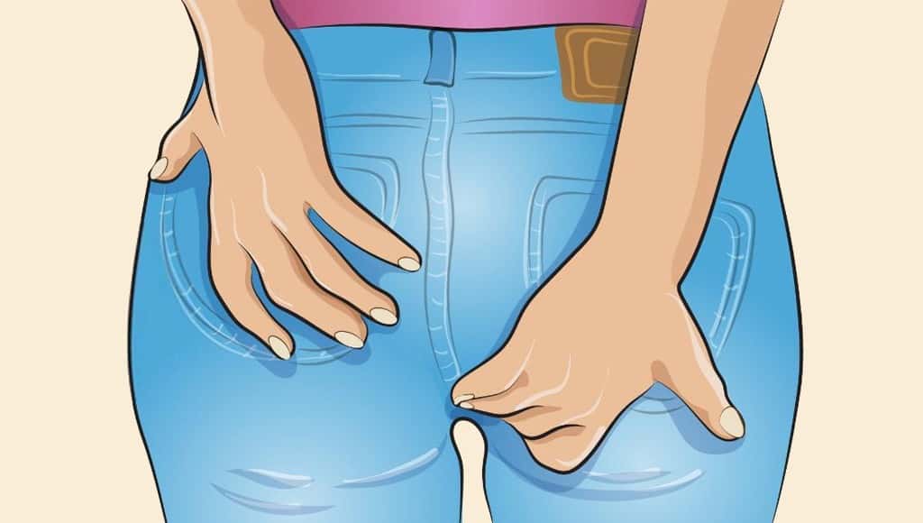 علاج الحكة في المؤخرة