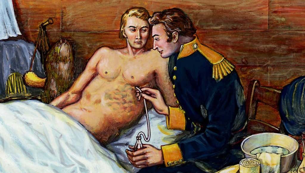 ألكسيس سانت مارتن، الرجل الذي كان يعاني من ناسور معدي