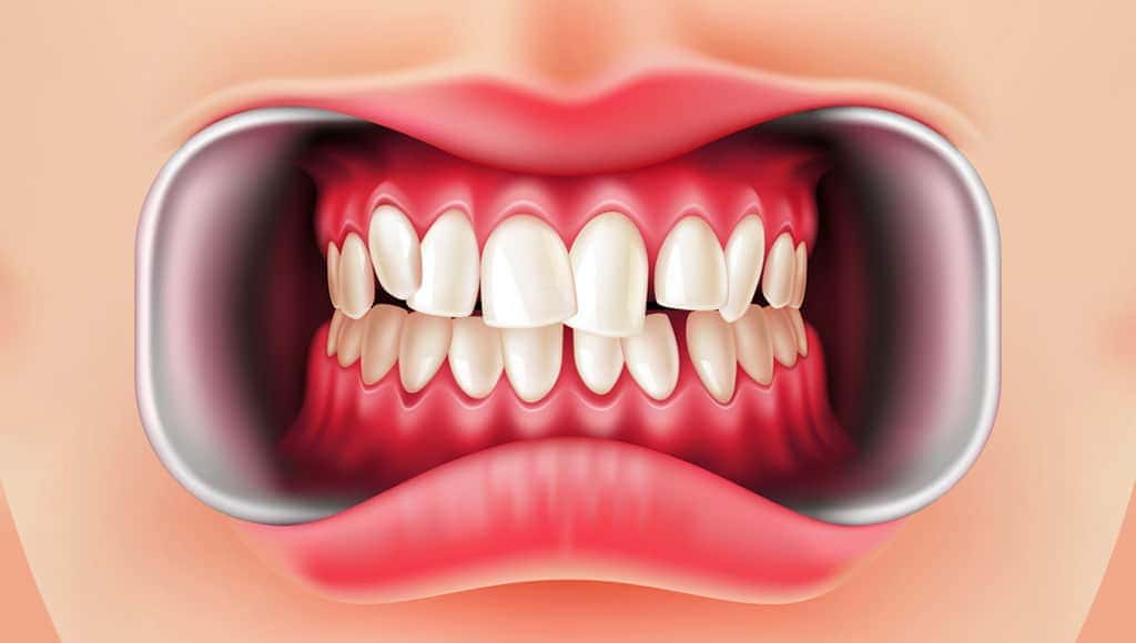 لماذا يعتبر الفم البشري كارثة من ناحية التصميم؟