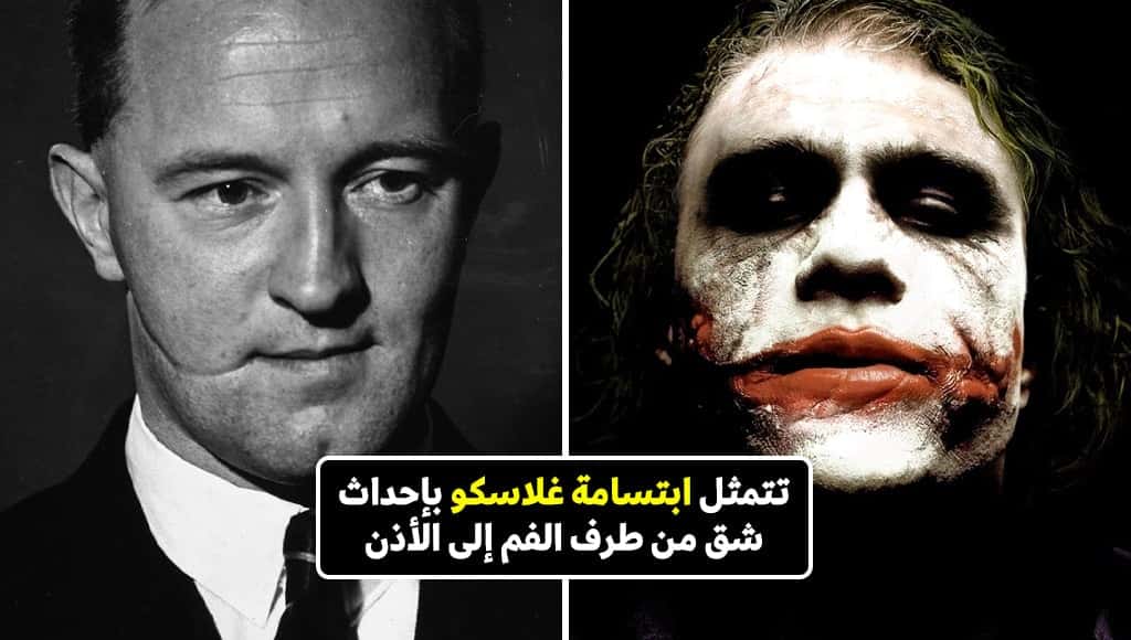 التاريخ المروّع لابتسامة غلاسكو: طريقة التعذيب الشنيعة التي ابتدعتها عصابات اسكتلندا الأولى