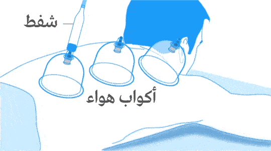 اماكن الحجامة