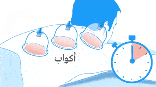 اماكن الحجامة
