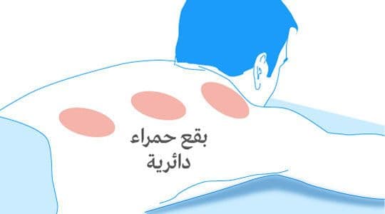 اماكن الحجامة
