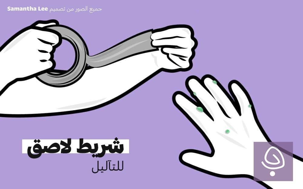 علاج التآليل