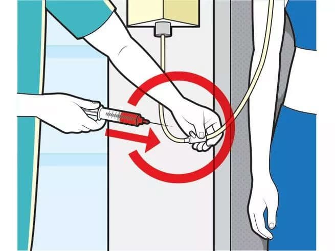 مرحلة أعمال الصيانة الخفيفة