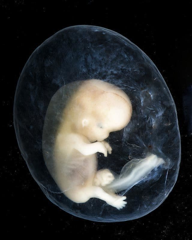 جنين في حوالي 8 إلى عشرة أسابيع من عمر الحمل المتوقع