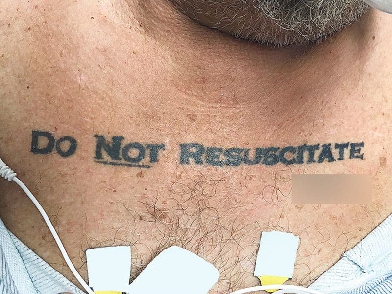 مريض في غيبوبة يحمل وشماً على صدره جاء فيه: ”لا تنعشوني“، يثير معضلة أخلاقيةً بين أطباء قسم الطوارئ في المشفى