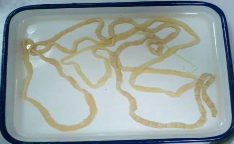 دودة شريطية