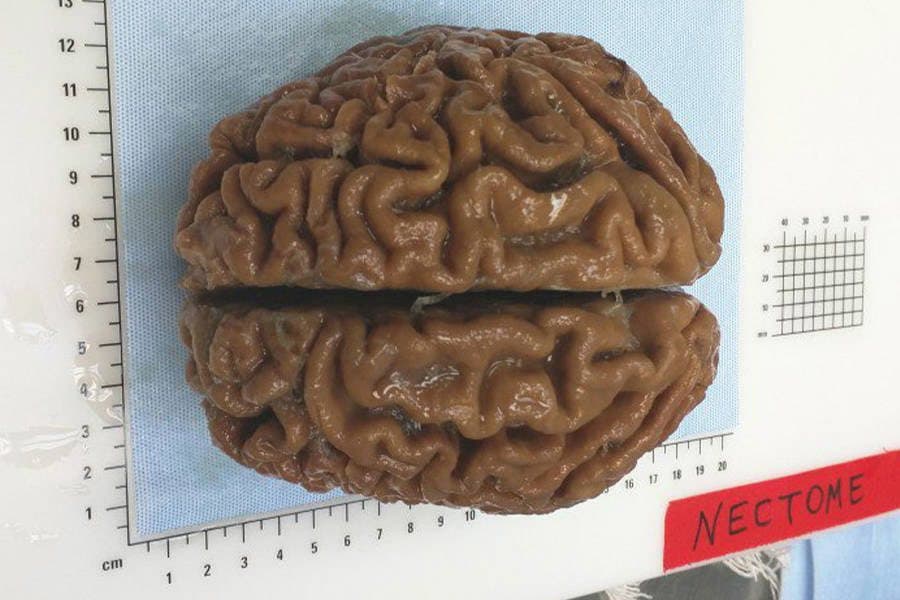 عينة شركة (نيكتوم) Nectome الوحيدة لدماغ إنسان محفوظ 