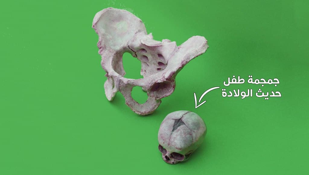 عسر وصعوبة الولادة