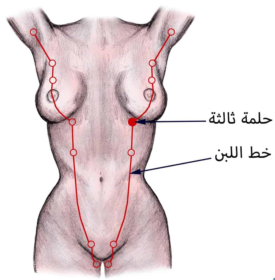 حلمة زائدة
