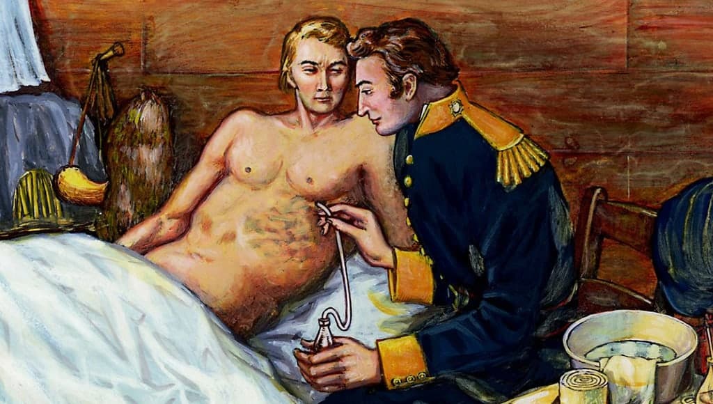 ألكسيس سانت مارتن، الرجل الذي كان يعاني من ناسور معدي