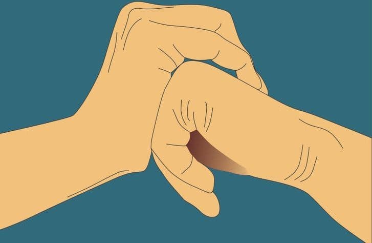 فرقعة الأصابع
