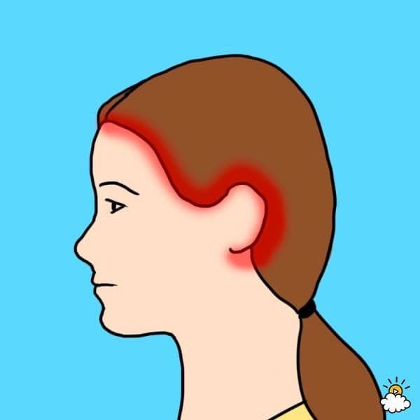 صداع إلتهاب الشرايين ذو الخلايا العرطلة