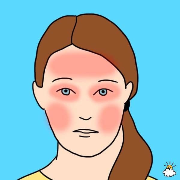صداع الجيوب