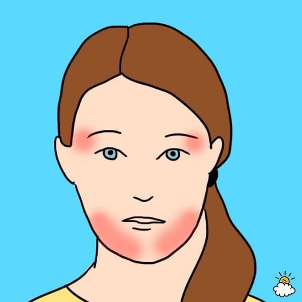صداع المفصل الصدغي الفكي