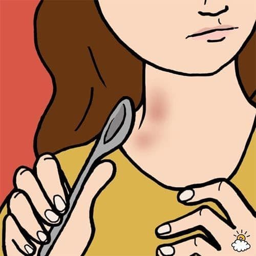 طرق إزالة آثار القبلات والعضات الجنسية