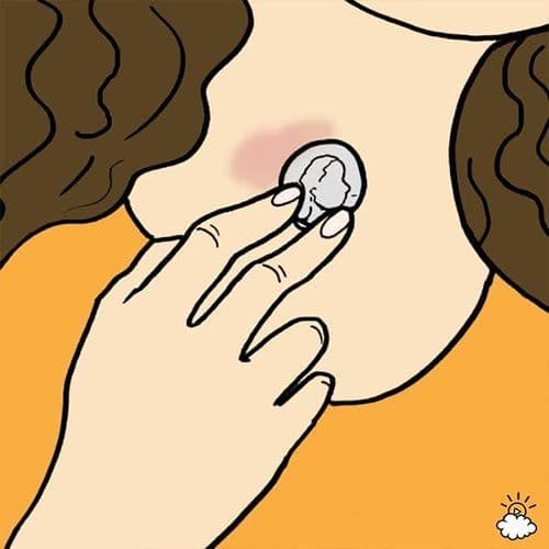 طرق إزالة آثار القبلات والعضات الجنسية