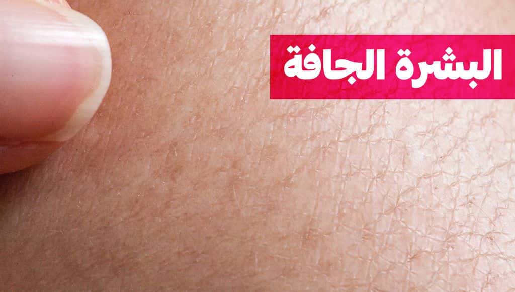 البشرة الجافة: الأسباب وطرق الوقاية
