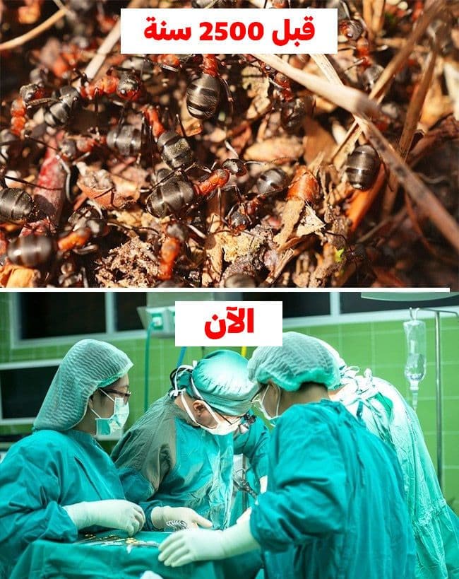 النمل الجراح