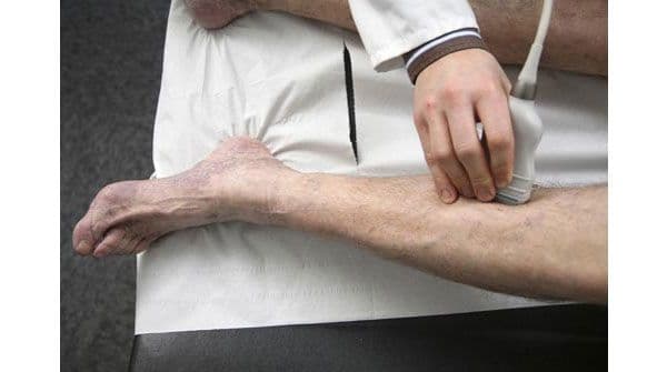 الشعور بالطراوة والألم في الجزء الخلفي من الساق السفلى