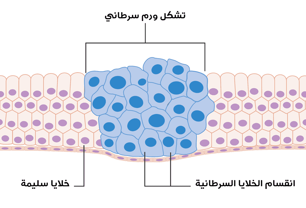 انقسام الخلايا السرطانية