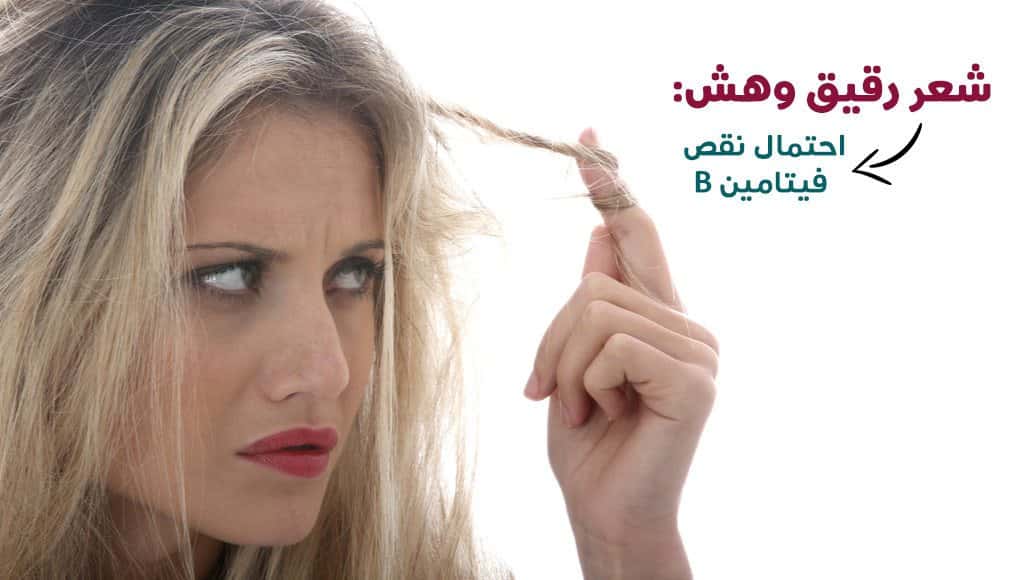 10 أعراض يخبرك بها جسمك بأنك بحاجة لتناول المزيد من الفيتامينات