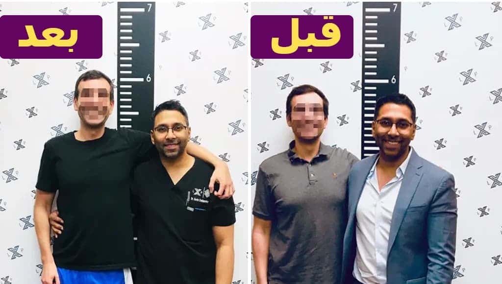 عيادة جراحية تجري عمليات لتمديد الأطراف، تتيح لك أن تصبح أكثر طولاً