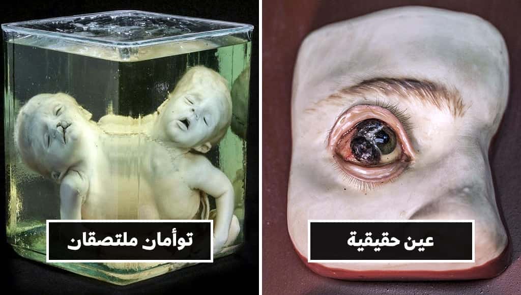 33 قطعة أثرية غريبة ذات قصص مخيفة ومزعجة جمعناها لكم من مختلفِ متاحف العالم