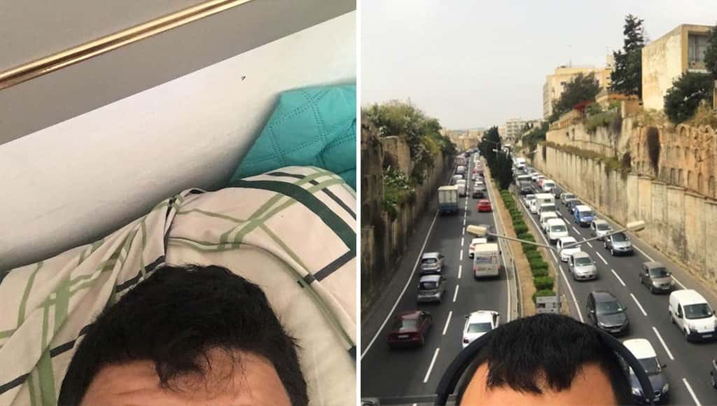 شاب يوناني يواظب على نشر صوراً لجبينه على إنستغرام على مر السنوات الـ6 الماضية
