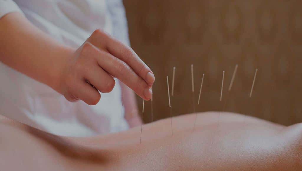 دخلك بتعرف الوخز بالإبر؟ وهل هي ممارسة طبية فعالة؟