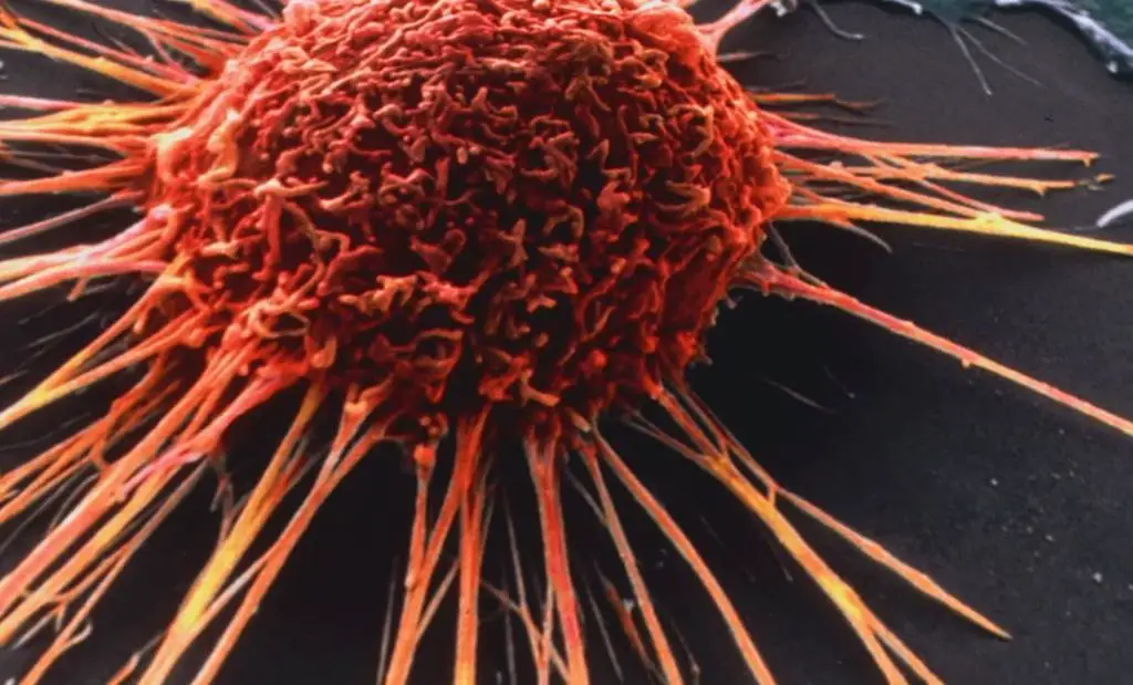 خلية السرطان