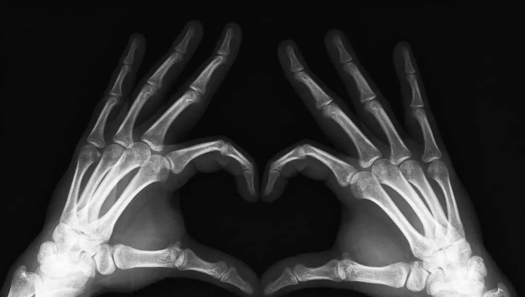 أشعة X