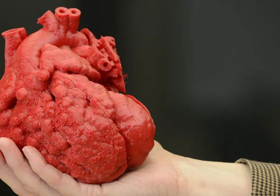 قلب اصطناعي