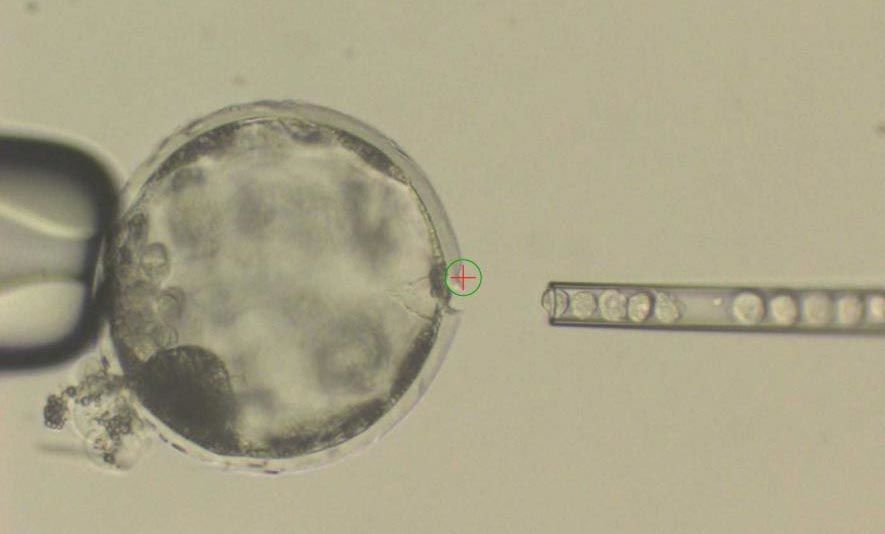 صورة تظهر كيس أريمي (قبيل الجنين) أثناء تلقيحه بخلايا بشرية