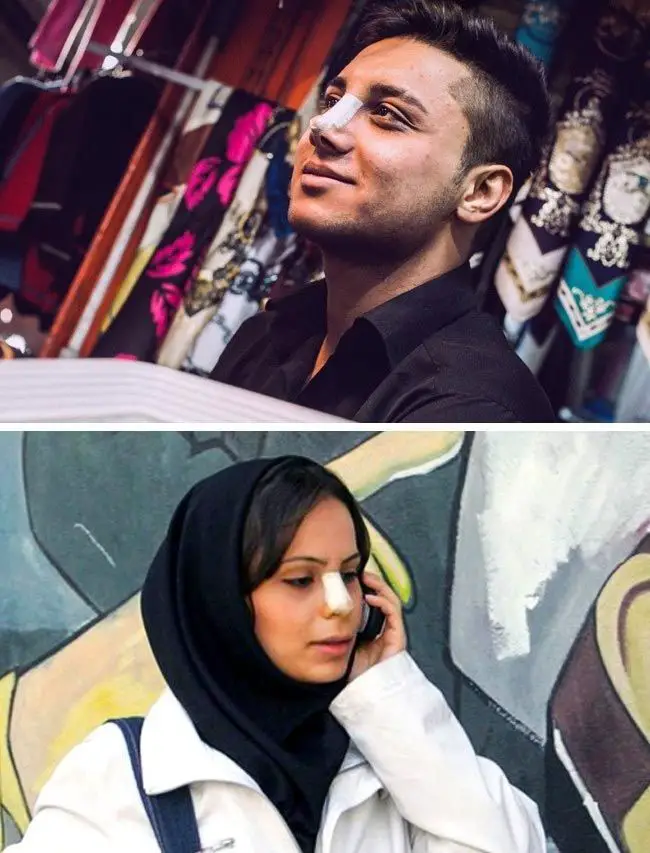 الضمادات الجراحية على الوجه في إيران