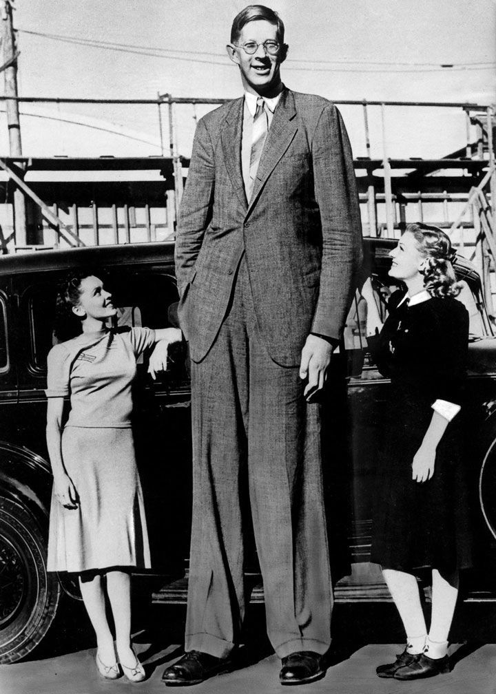 روبرت وادلو مقارنة بفتاتين بطول طبيعي