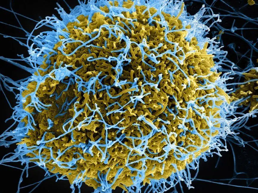 جزيئات فيروس أيبولا في مهدها ضمن خلية مصابة (باللون الأزرق)، المعهد الوطني للحساسية والأمراض المعدية والمعاهد الوطنية للصحة.