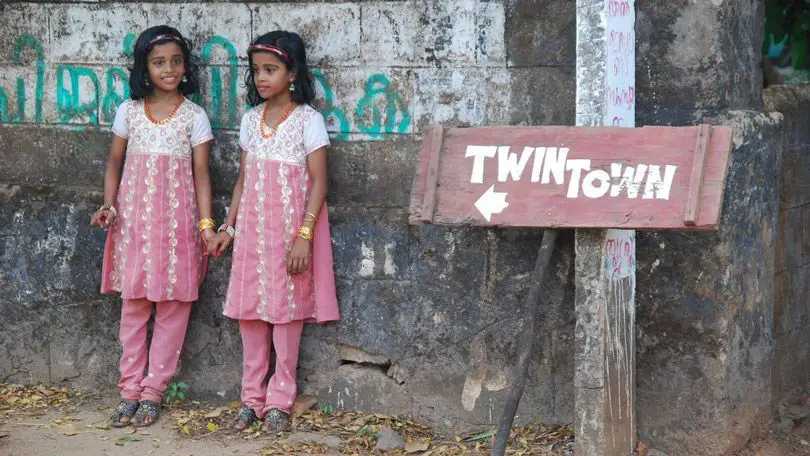 زوج من الفتيات التوائم في ”بلدة التوائم“ في (كودينهاي) في الهند.