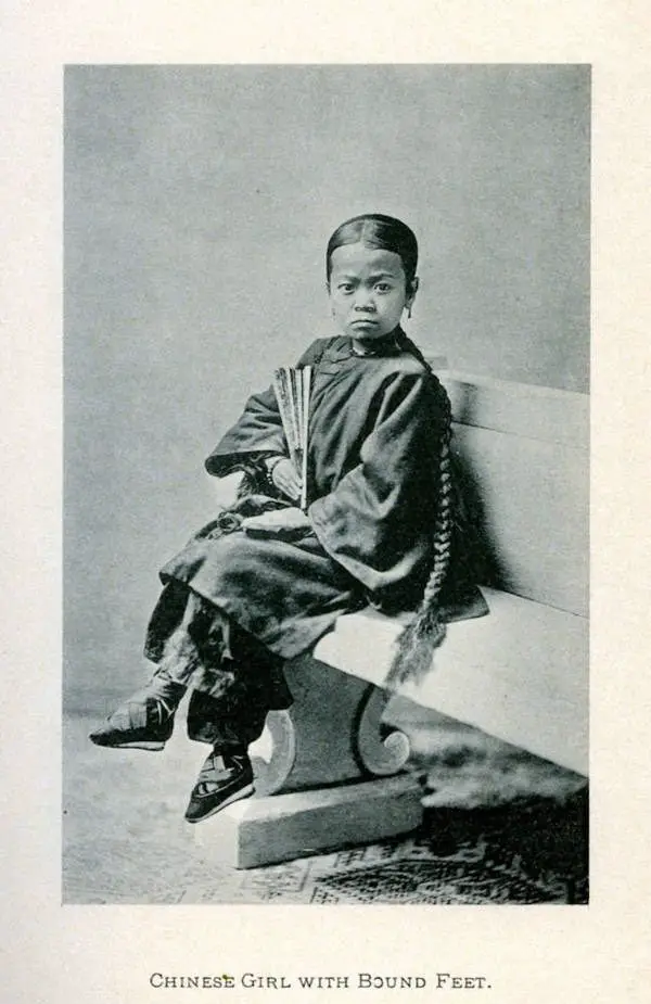 فتاة صينية صغيرة مع أقدام مضمدة.