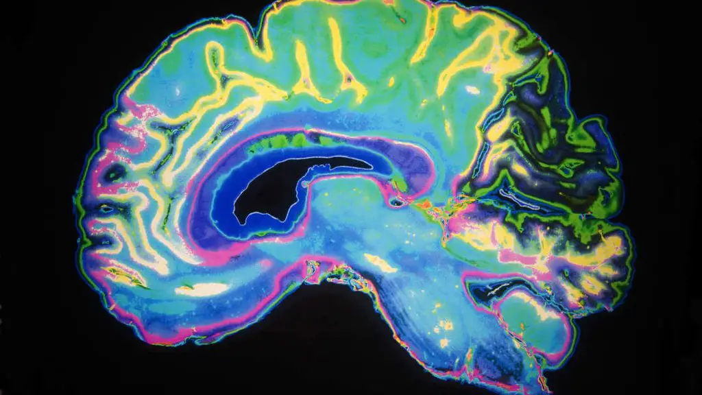 صورة بالأشعة لدماغ بشري