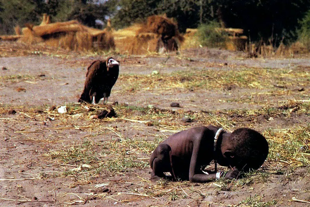 الطفل السوداني الجائع الذي تظهر عليه آثار المجاعة