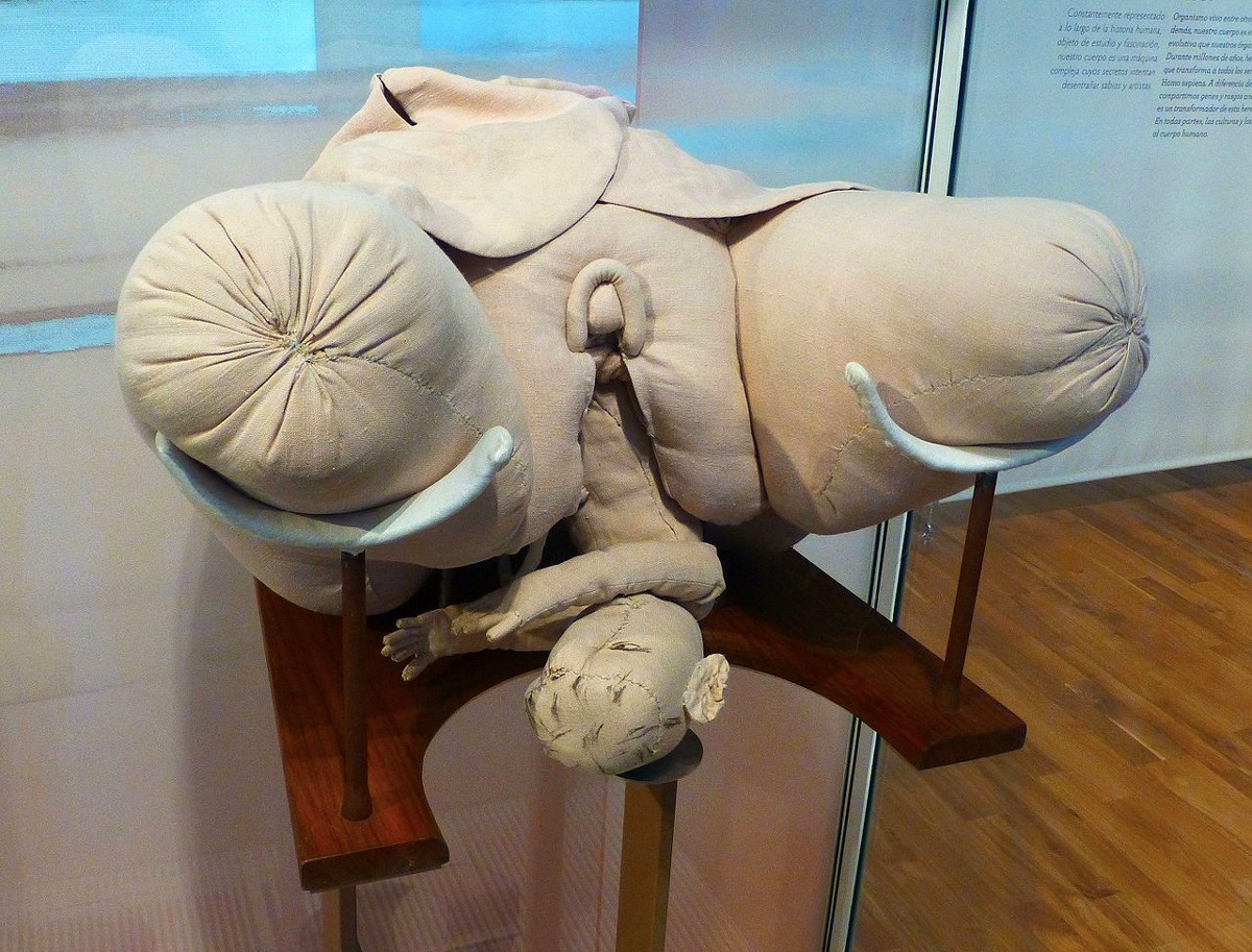صورة لمجسم الولادة الخاص بالسيدة (دو كودري) تظهر خروج المولود الجديد بوضعية يكون فيها وجهه متجه إلى الأعلى.