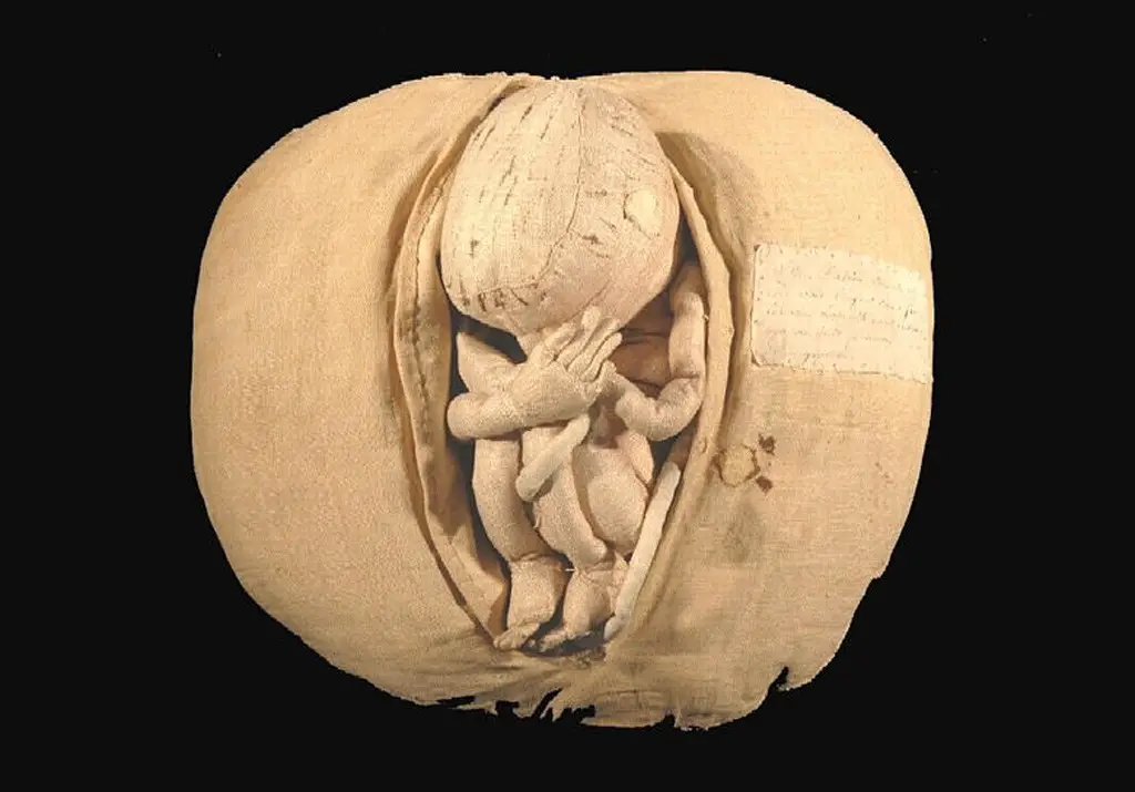 مجسم يظهر وضعية الجنين في بطن امه.