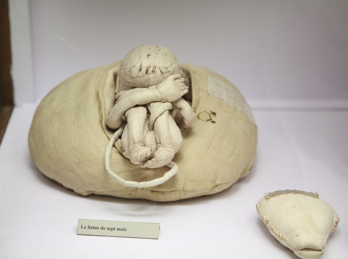 صورة لمجسم الولادة الخاص بالسيدة (دو كودري) تظهر شكل الجنين في بطن أمه يبلغ من العمر سبعة أشهر، رصيد الصورة: مدونة متحف DITTRICK