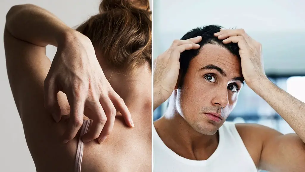 قد يشير تساقط الشعر إلى مشاكل صحية أكثر خطورة.