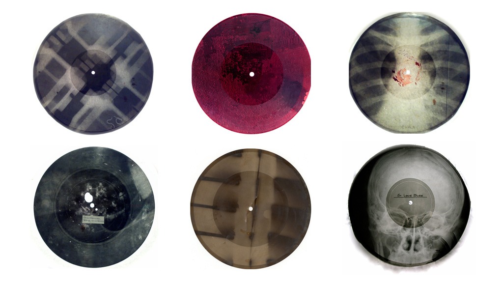 اسطوانات موسيقية تبدو وكأنها صور أشعة X. صورة: The X-Ray Audio Project.