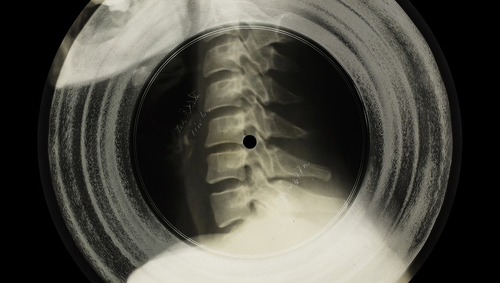 اسطوانات موسيقية تبدو وكأنها صور أشعة X. صورة: The X-Ray Audio Project