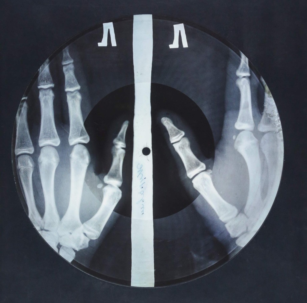 اسطوانة موسيقية مموهة على شكل صورة أشعة X