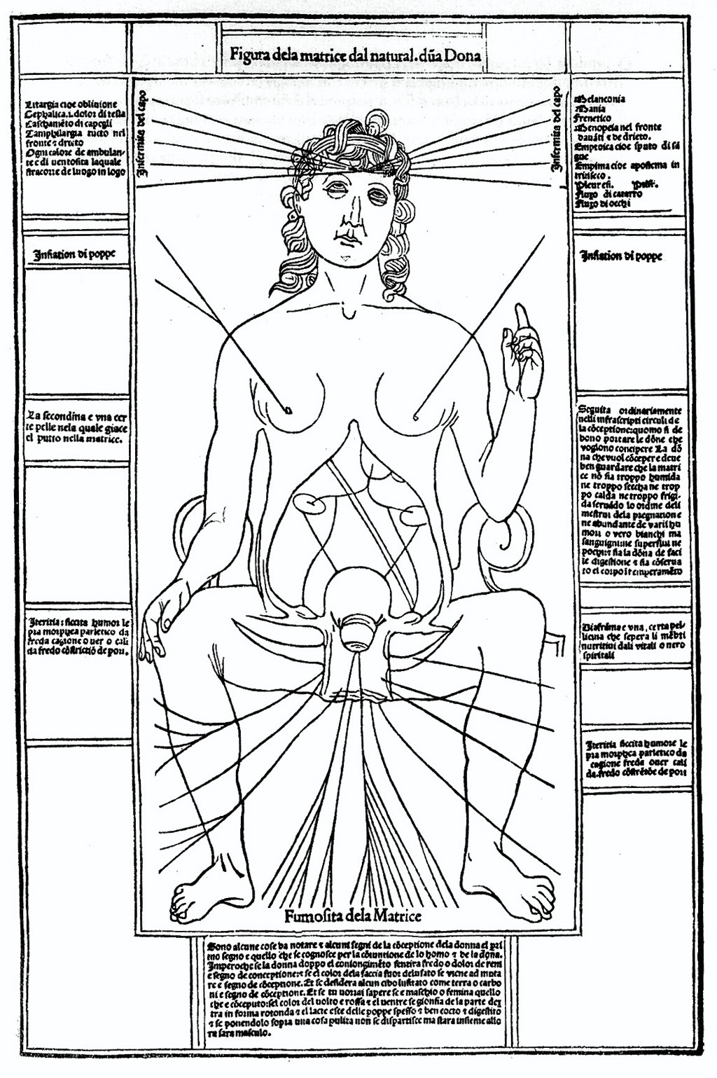 رسم لـ (ليوناردو دافنشي) لتشريح جسم الأنثى، وخاصة الأعضاء التناسلية، يعود هذا الرسم إلى أواخر القرن الـ 15.